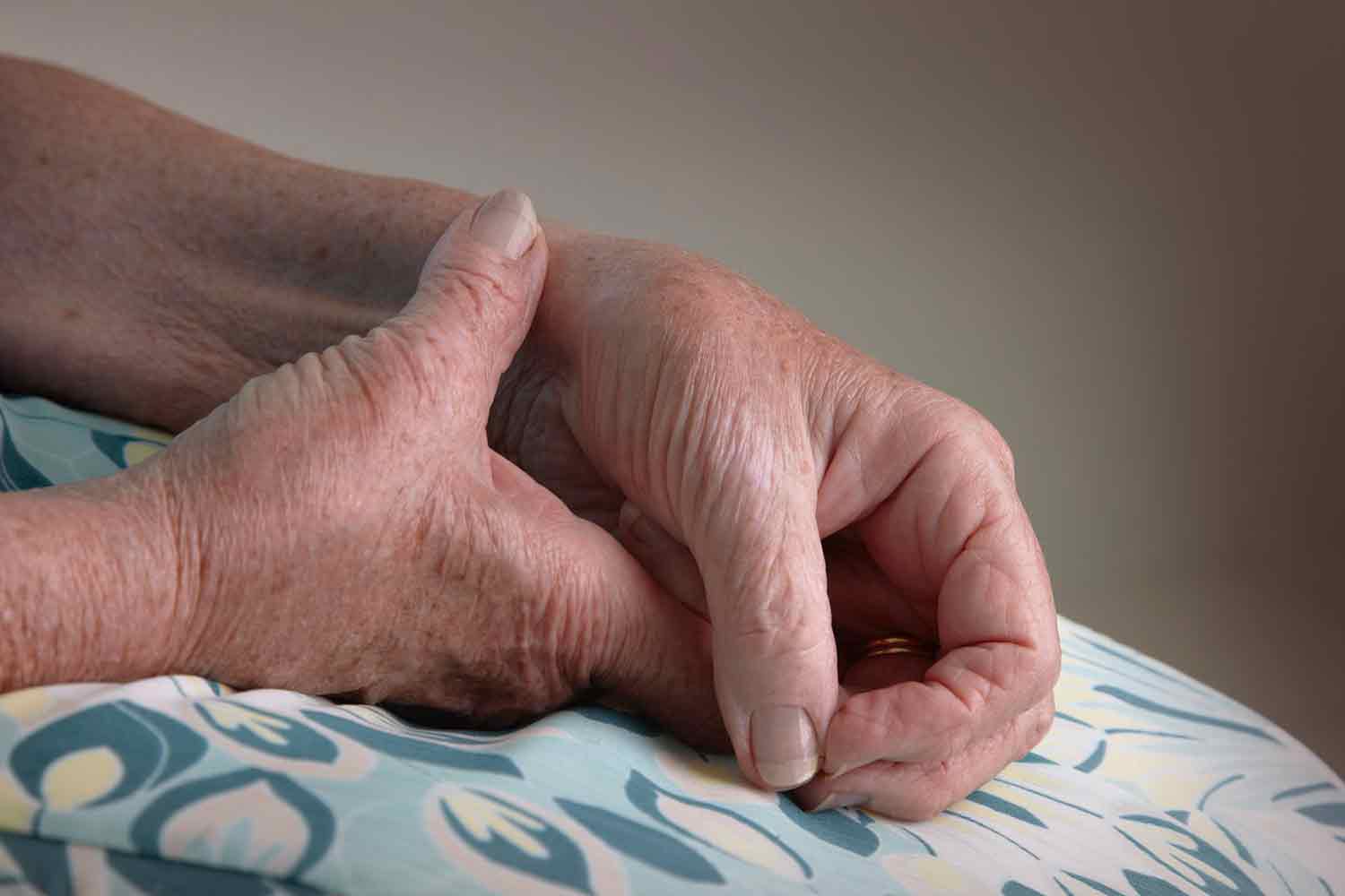 درمان آرتروز مچ دست